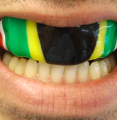 Mouth Guards